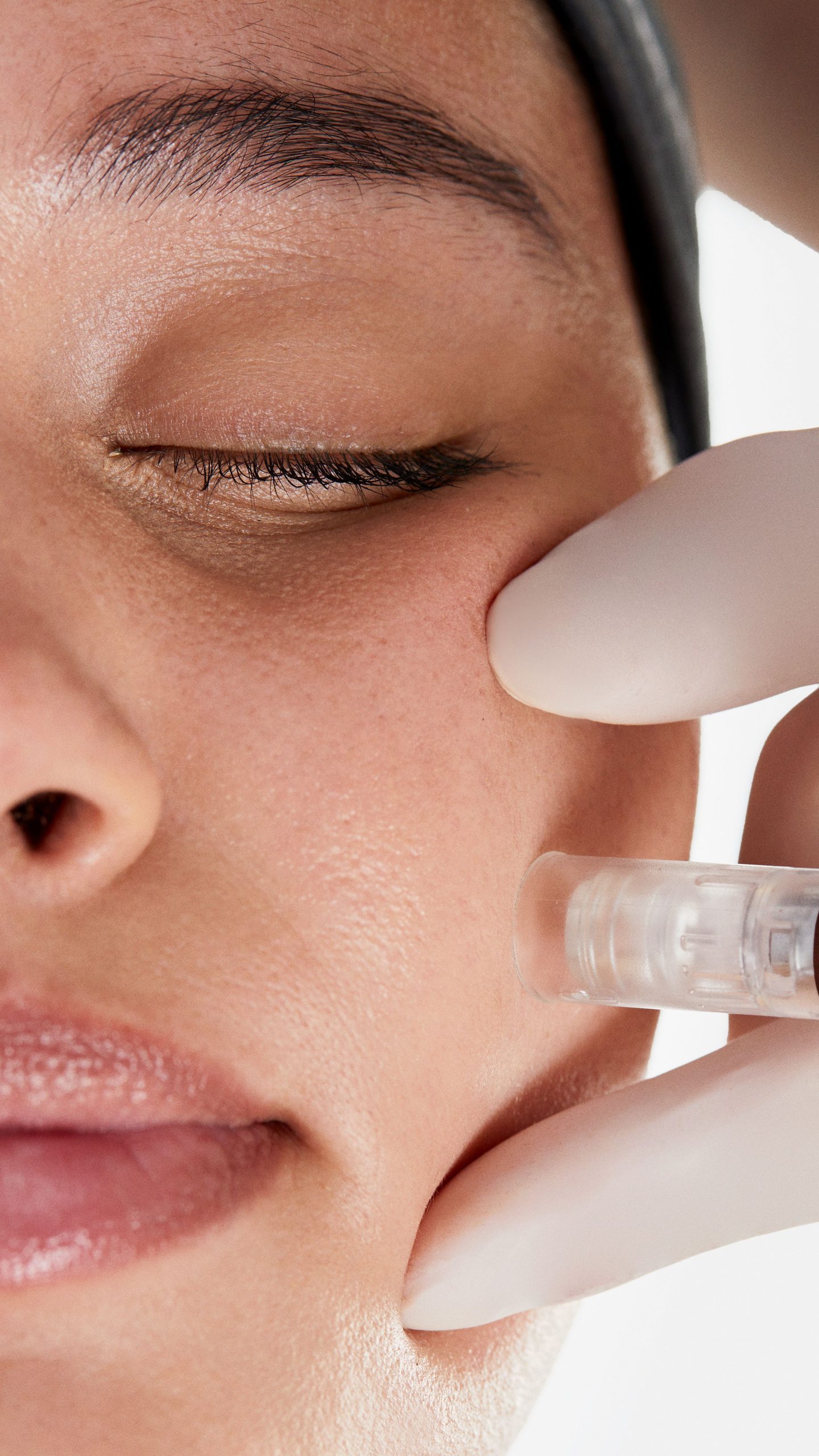 9x16 Microneedling - Model 4.jpg